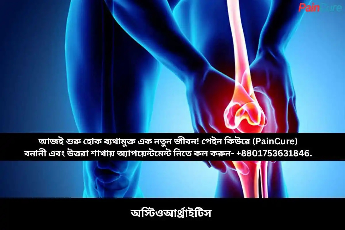 অস্টিওআর্থ্রাইটিস