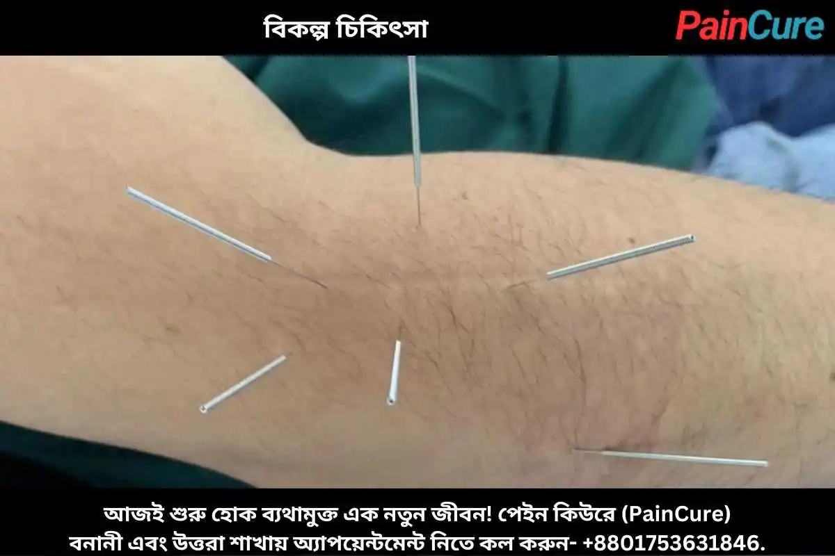 বিকল্প চিকিৎসা