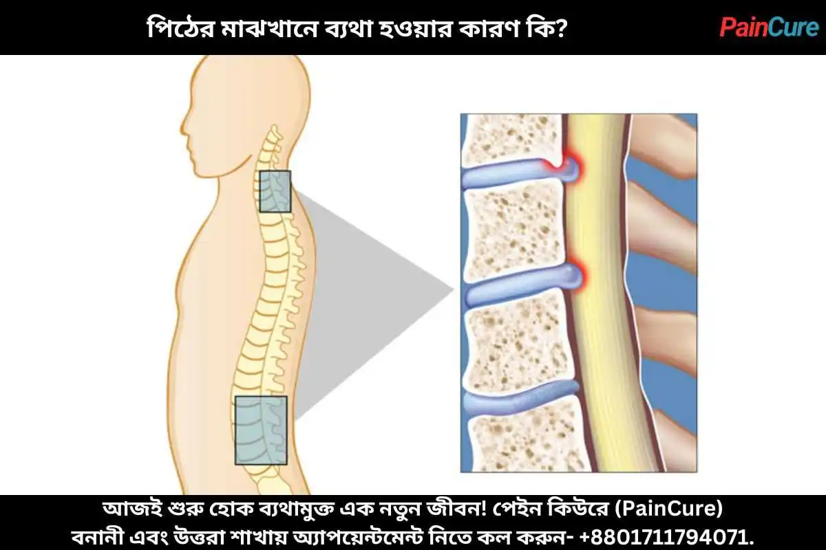 পিঠের মাঝখানে ব্যথা হওয়ার কারণ কি