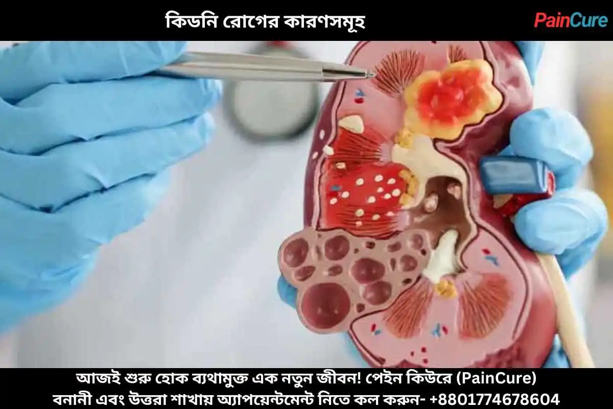 কিডনি রোগের কারণসমূহ