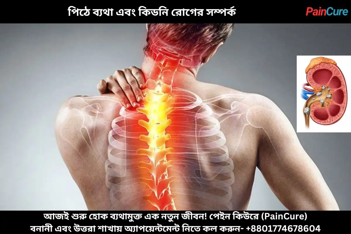 পিঠে ব্যথা এবং কিডনি রোগের সম্পর্ক