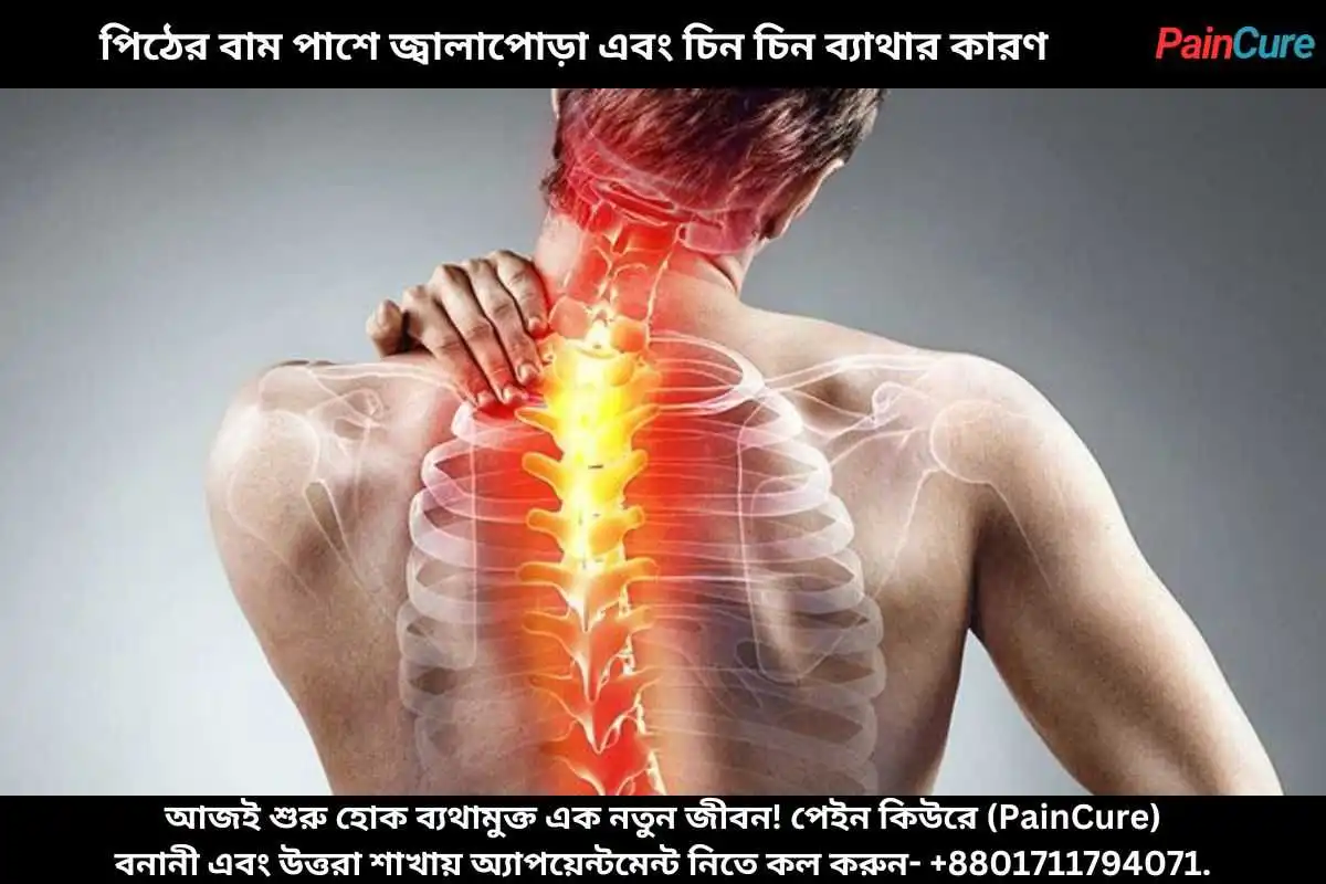 পিঠের বাম পাশে জ্বালাপোড়া এবং চিন চিন ব্যাথার কারণ