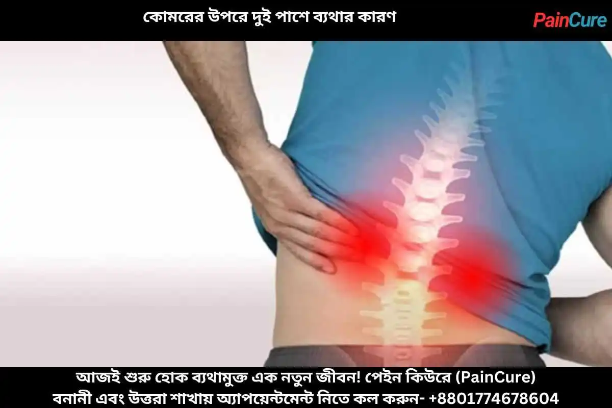 কোমরের উপরে দুই পাশে ব্যথার কারণ