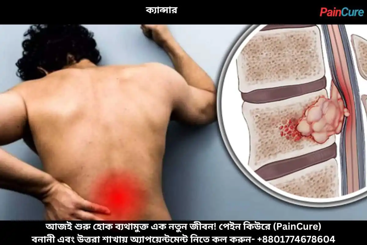 ক্যান্সার