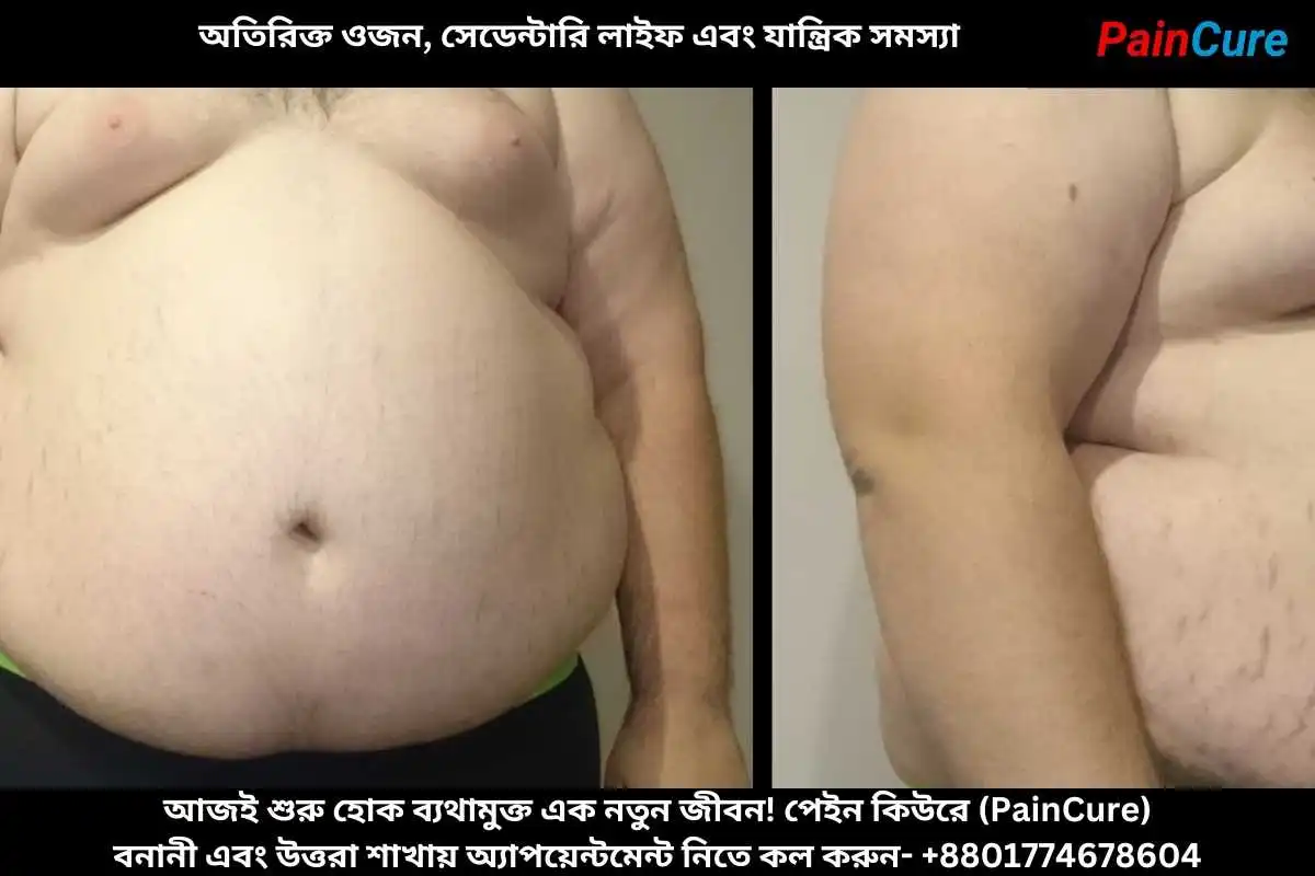 অতিরিক্ত ওজন, সেডেন্টারি লাইফ এবং যান্ত্রিক সমস্যা