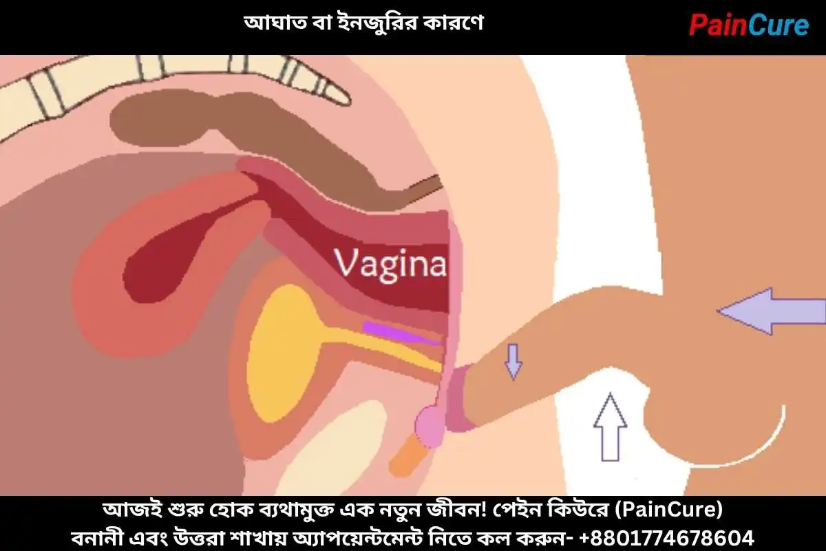 আঘাত বা ইনজুরির কারণে