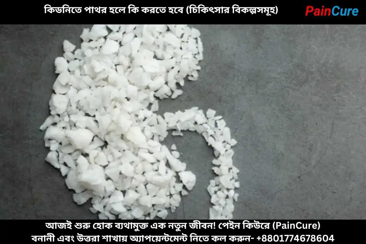 কিডনিতে পাথর হলে কি করতে হবে (চিকিৎসার বিকল্পসমূহ)