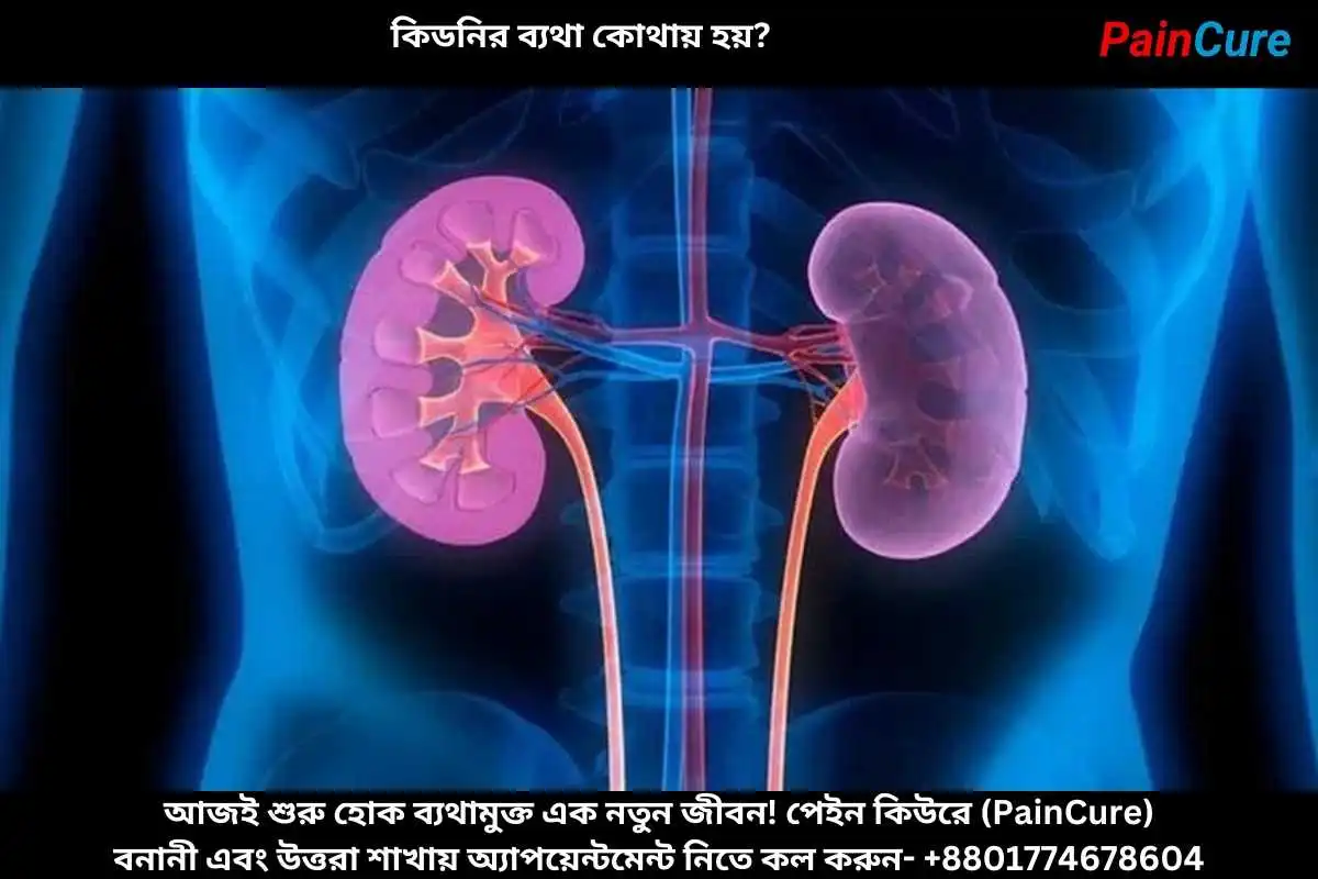 কিডনির ব্যথা কোথায় হয়