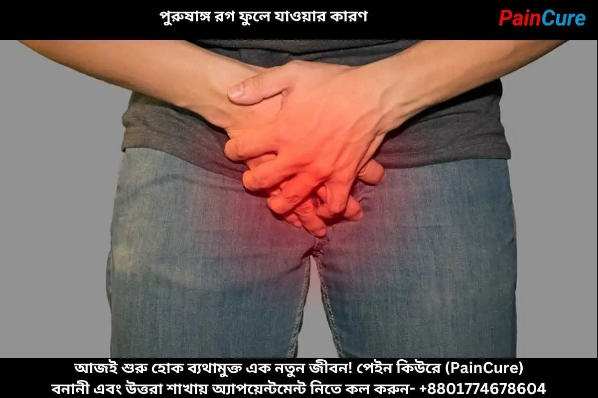 পুরুষাঙ্গ রগ ফুলে যাওয়ার কারণ
