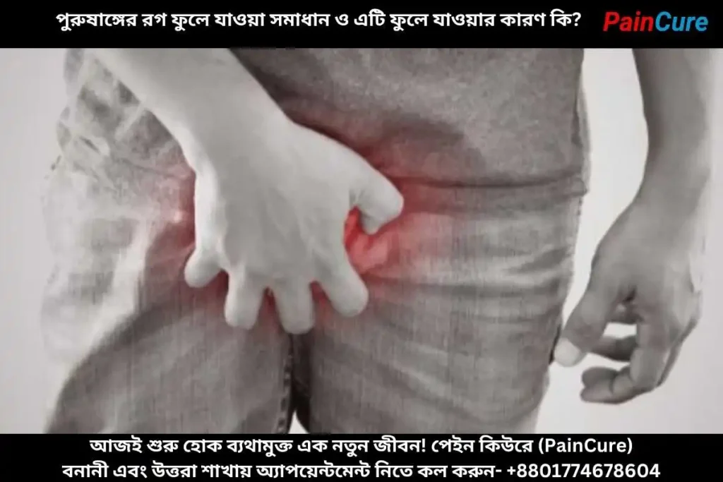 পুরুষাঙ্গের রগ ফুলে যাওয়া সমাধান ও এটি ফুলে যাওয়ার কারণ কি