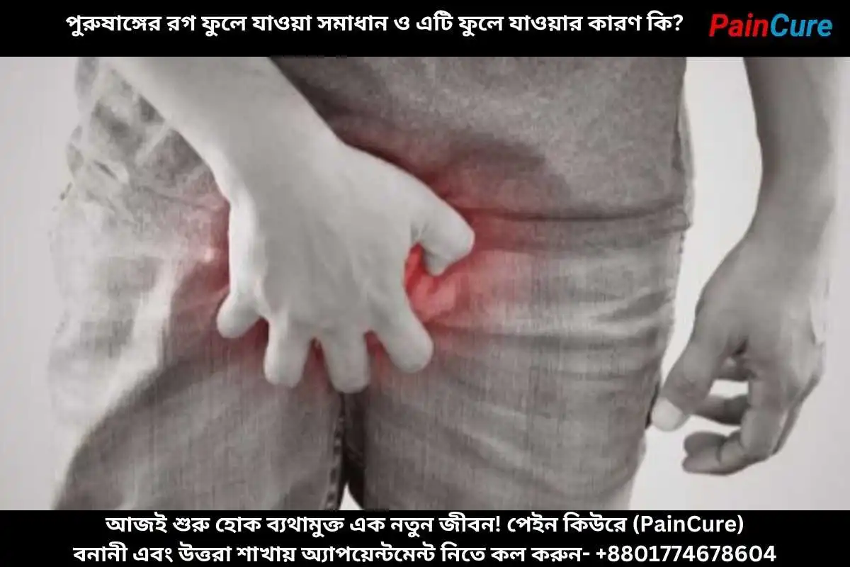 পুরুষাঙ্গের রগ ফুলে যাওয়া সমাধান ও এটি ফুলে যাওয়ার কারণ কি