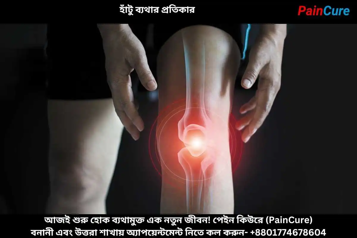 হাঁটু ব্যথার প্রতিকার