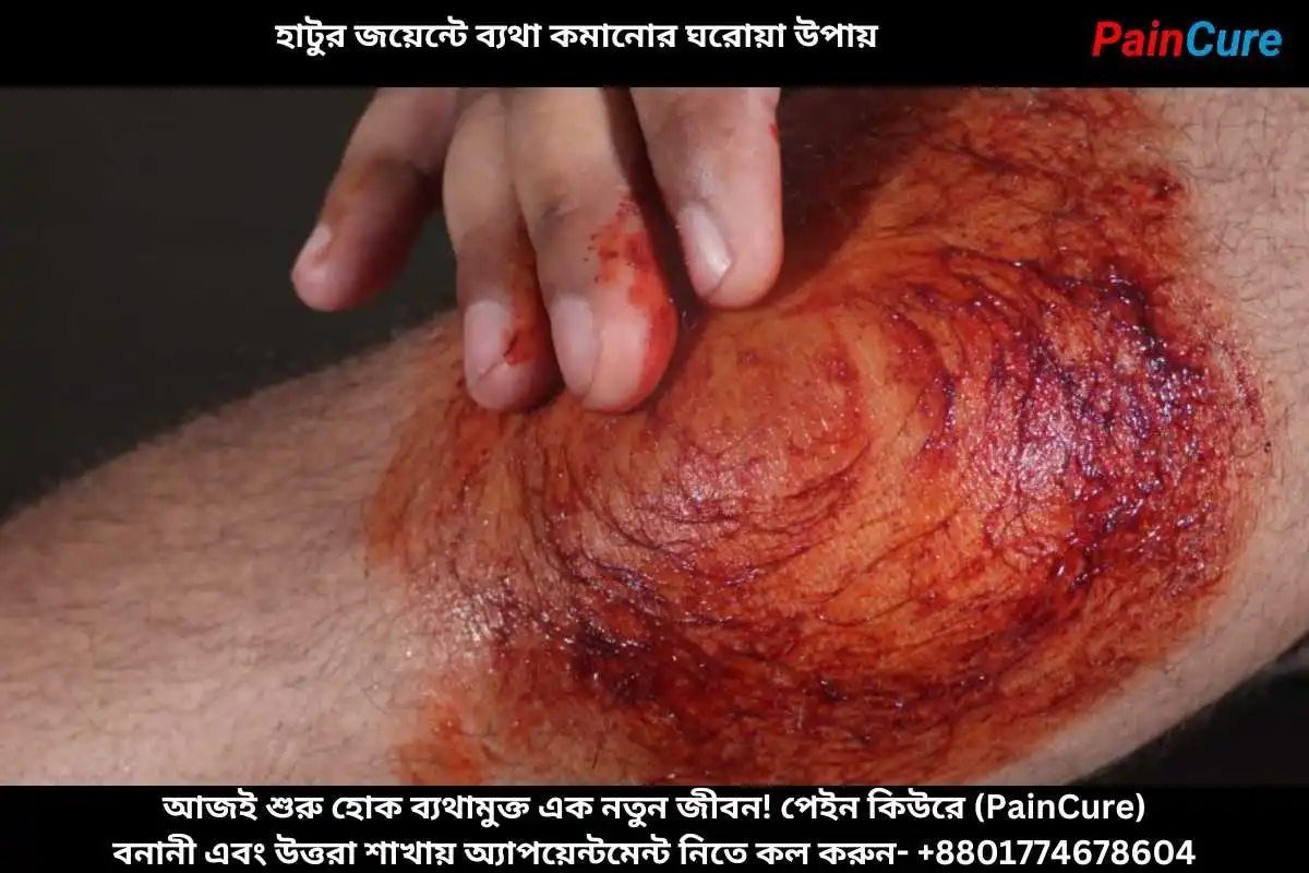 হাটুর জয়েন্টে ব্যথা কমানোর ঘরোয়া উপায়