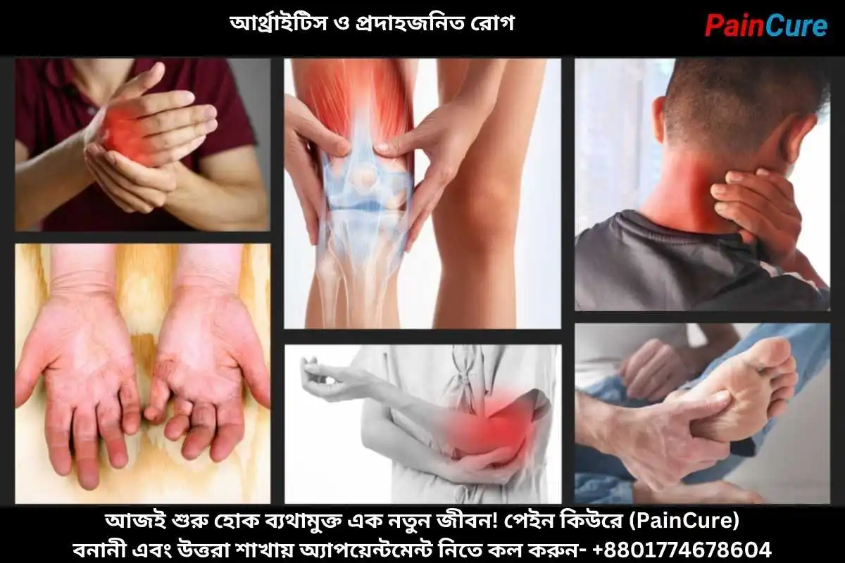 আর্থ্রাইটিস ও প্রদাহজনিত রোগ