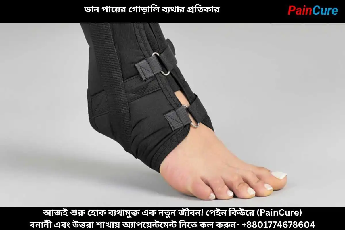 ডান পায়ের গোড়ালি ব্যথার প্রতিকার