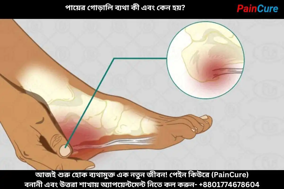 পায়ের গোড়ালি ব্যথা কী এবং কেন হয়