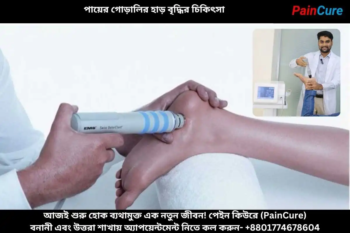 পায়ের গোড়ালির হাড় বৃদ্ধির চিকিৎসা