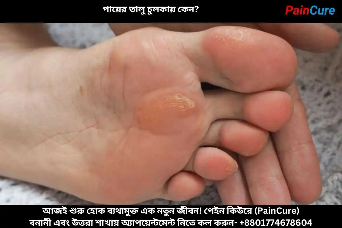 পায়ের তালু চুলকায় কেন