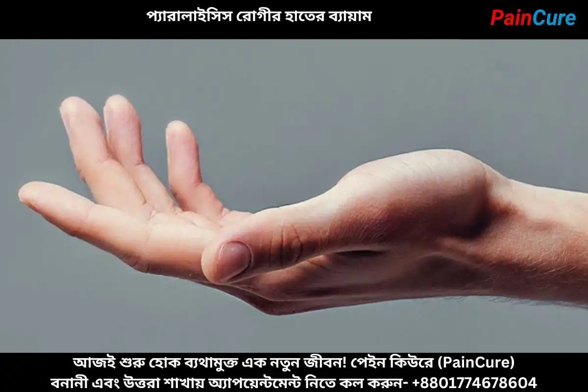 প্যারালাইসিস রোগীর হাতের ব্যায়াম