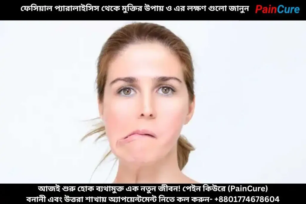 ফেসিয়াল প্যারালাইসিস থেকে মুক্তির উপায় ও এর লক্ষণ গুলো জানুন