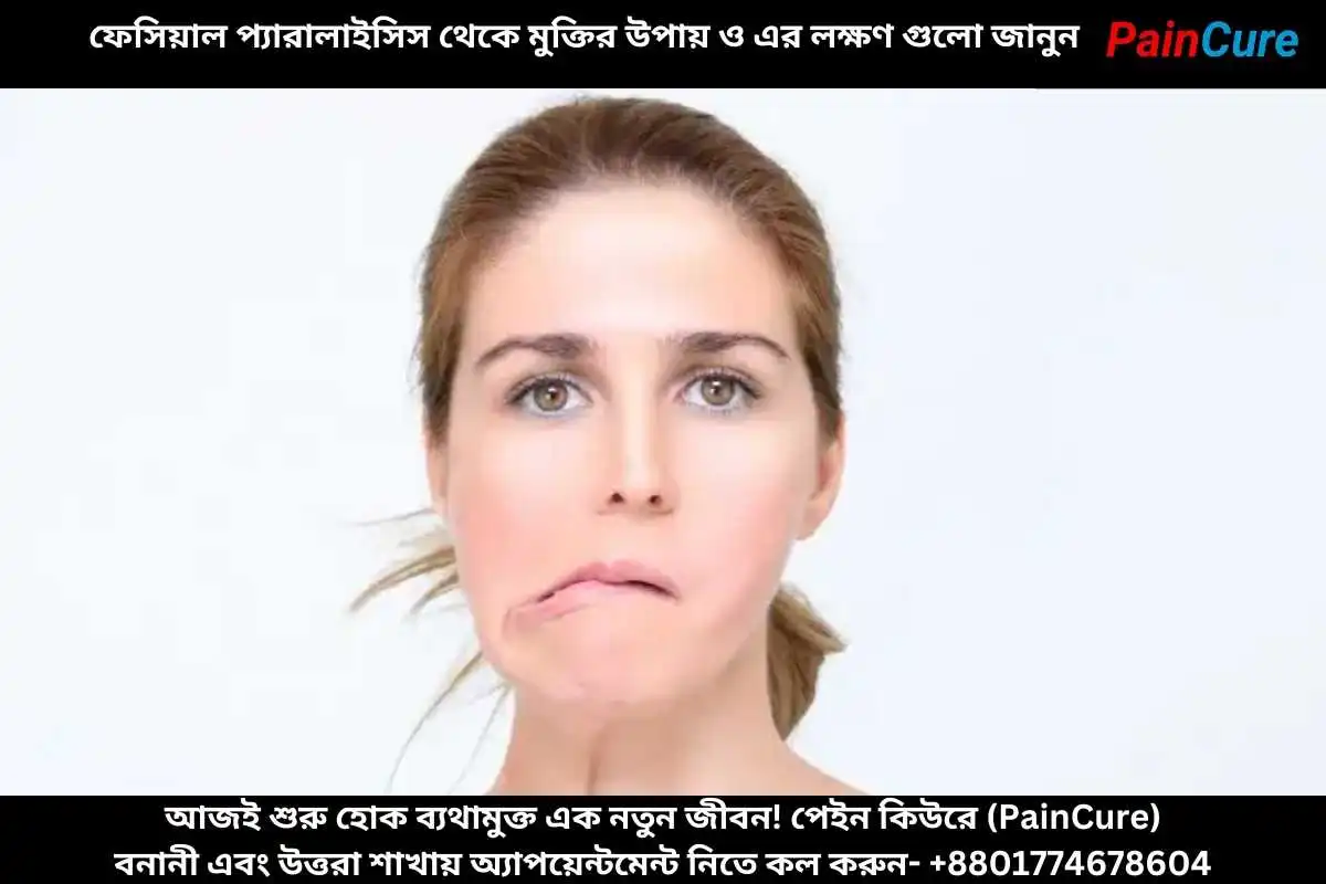 ফেসিয়াল প্যারালাইসিস থেকে মুক্তির উপায় ও এর লক্ষণ গুলো জানুন