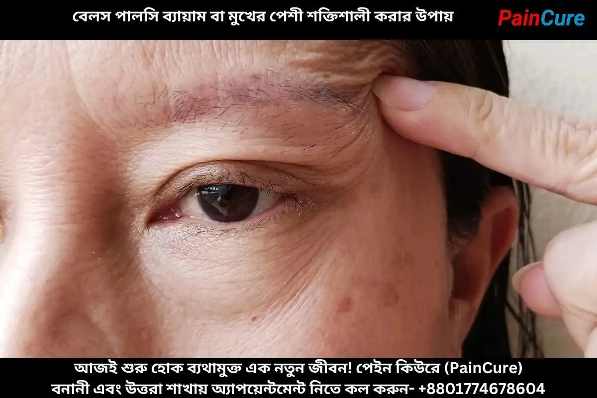 বেলস পালসি ব্যায়াম বা মুখের পেশী শক্তিশালী করার উপায়