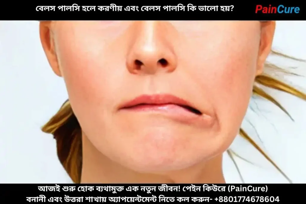 বেলস পালসি হলে করণীয় এবং বেলস পালসি কি ভালো হয়