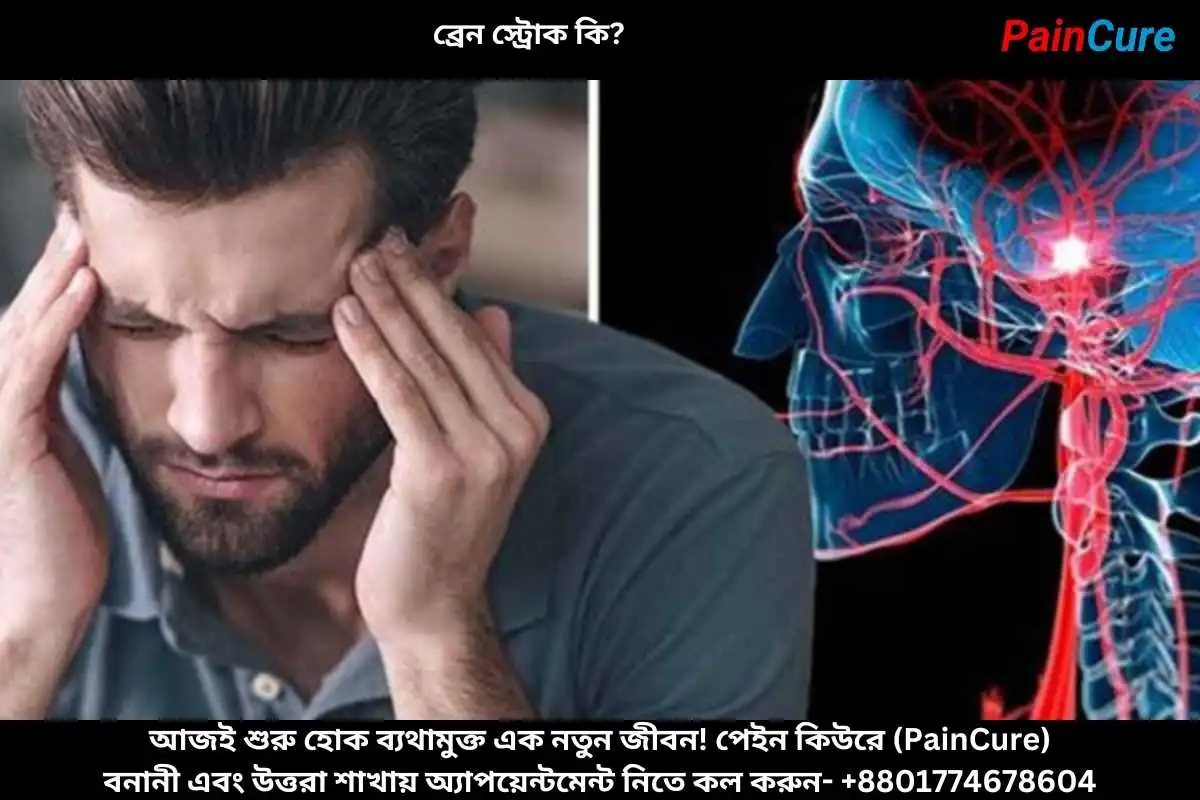 ব্রেন স্ট্রোক কি