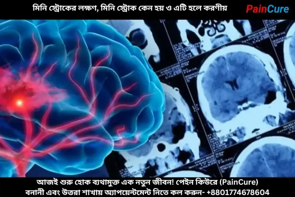 মিনি স্ট্রোকের লক্ষণ, মিনি স্ট্রোক কেন হয় ও এটি হলে করণীয়