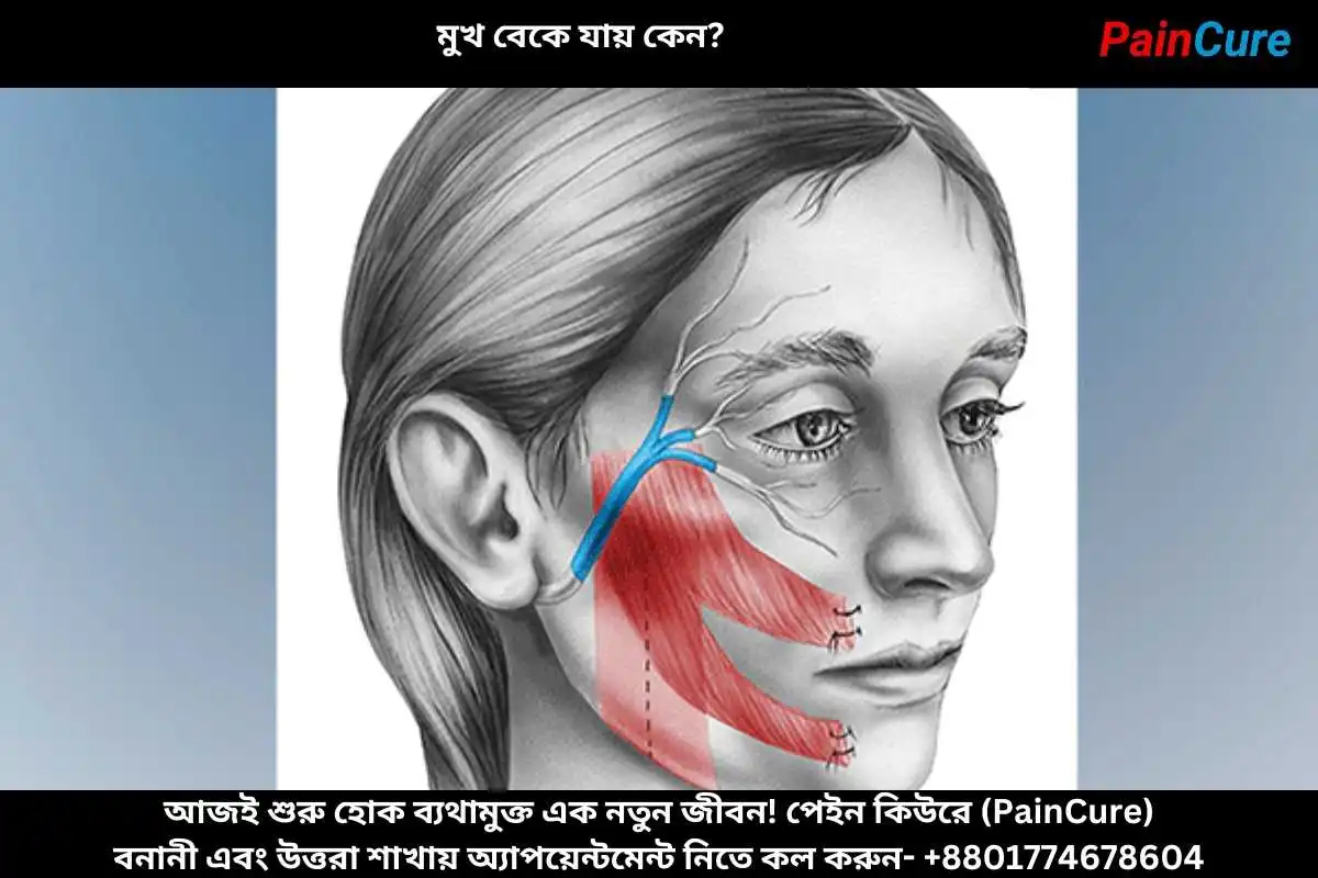 মুখ বেকে যায় কেন