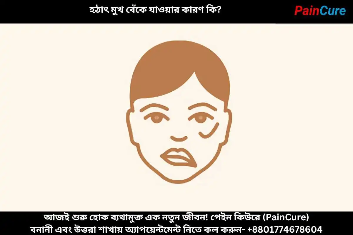 হঠাৎ মুখ বেঁকে যাওয়ার কারণ কি