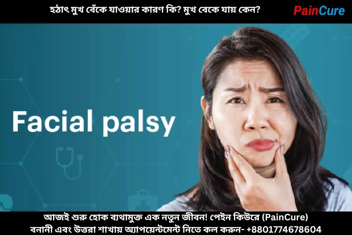 হঠাৎ মুখ বেঁকে যাওয়ার কারণ কি