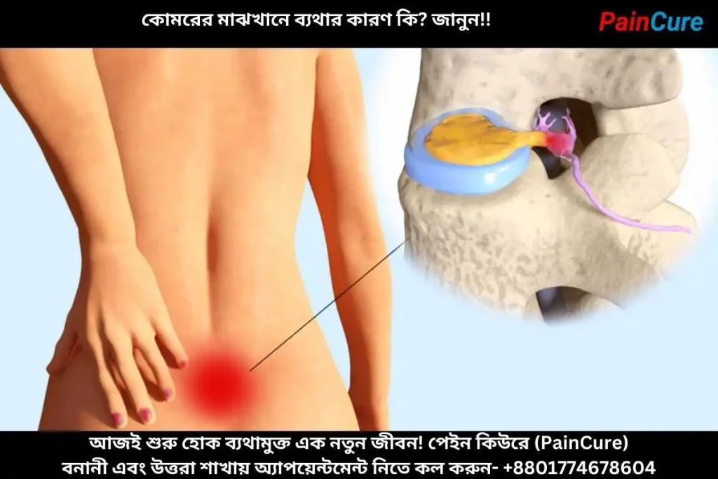 কোমরের মাঝখানে ব্যথার কারণ