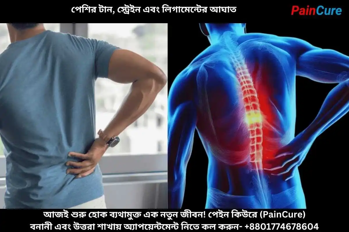 পেশির টান, স্ট্রেইন এবং লিগামেন্টের আঘাত