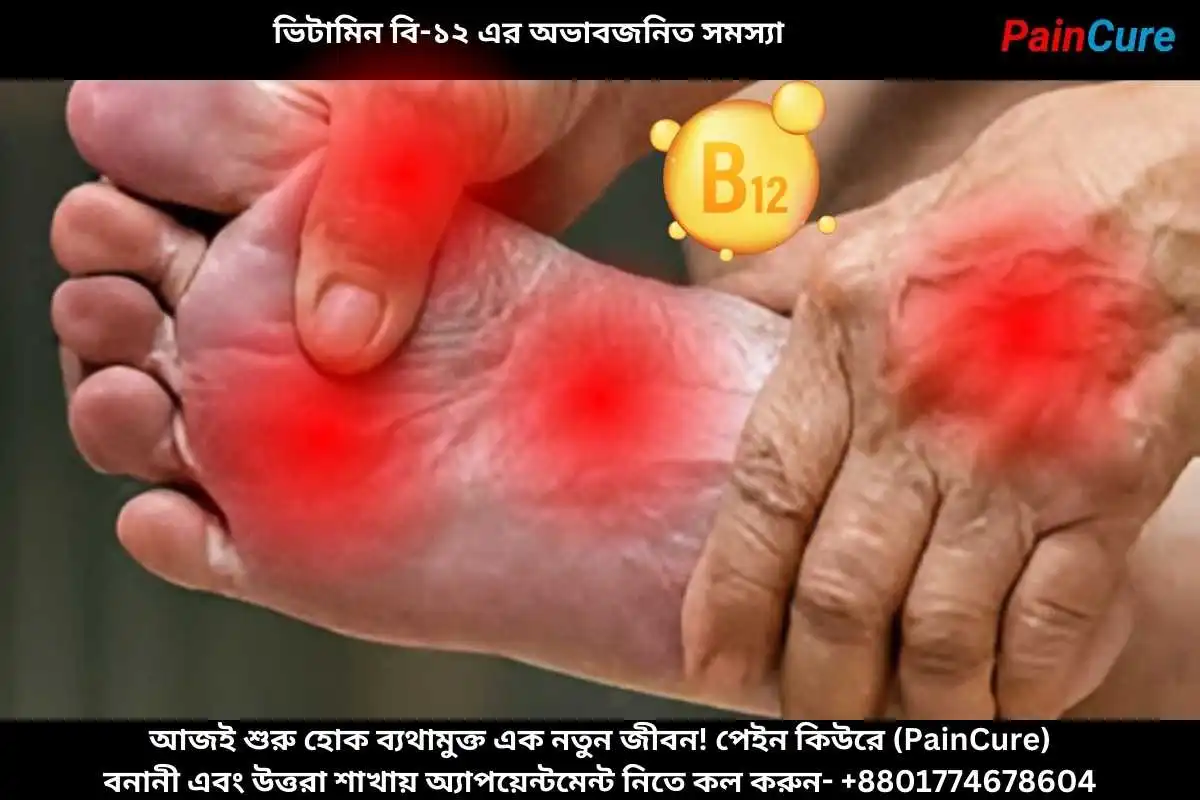 ভিটামিন বি-১২ এর অভাবজনিত সমস্যা