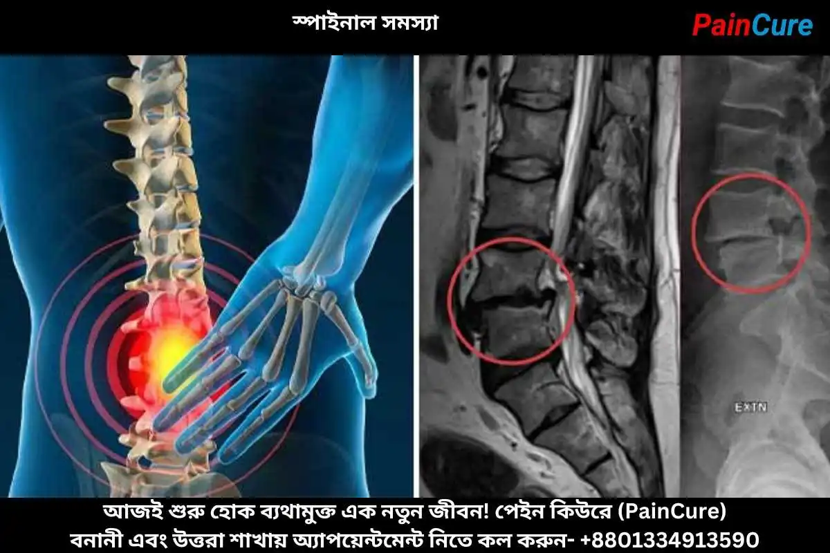 স্পাইনাল সমস্যা