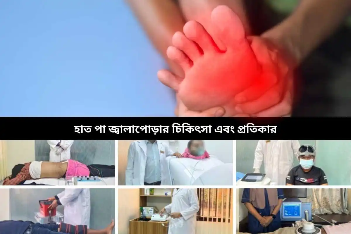 হাত পা জ্বালাপোড়ার চিকিৎসা এবং প্রতিকার