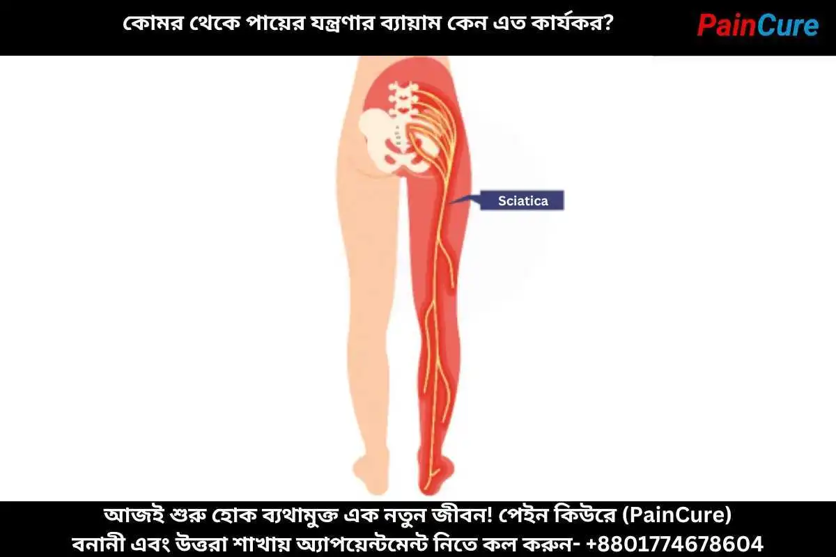 কোমর থেকে পায়ের যন্ত্রণার ব্যায়াম কেন এত কার্যকর?
